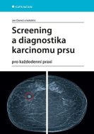 Screening a diagnostika karcinomu prsu - cena, srovnání