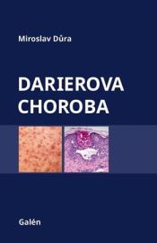 Darierova choroba