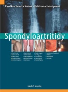 Spondyloartritidy - cena, srovnání