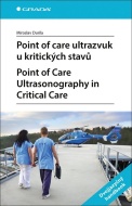 Point of care ultrazvuk u kritických stavů - cena, srovnání