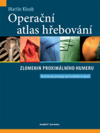 Operační atlas hřebování zlomenin proximálního humeru - cena, srovnání