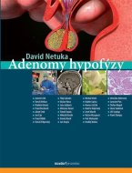 Adenomy hypofýzy - cena, srovnání