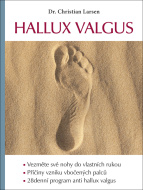 Hallux valgus - cena, srovnání