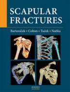 Scapular fractures - cena, srovnání