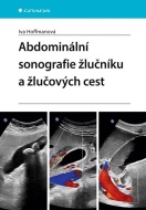 Abdominální sonografie žlučníku a žlučových cest - cena, srovnání