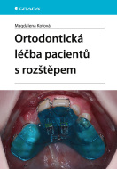 Ortodontická léčba pacientů s rozštěpem - cena, srovnání