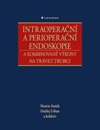 Intraoperační a perioperační endoskopie a kombinované výkony na trávicí trubici - cena, srovnání