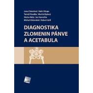 Diagnostika zlomenin pánve a acetabula - cena, srovnání