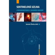 Sentinelová uzlina - cena, srovnání