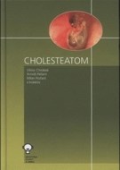 Cholesteatom - cena, srovnání
